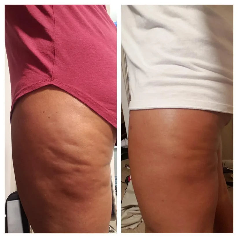 Vaultrys™ - Anti-Cellulite Elixir