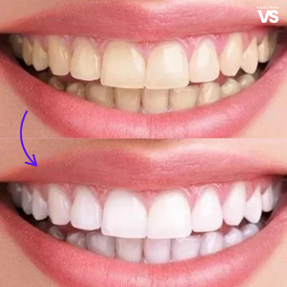 VAULTRYS® smilekit
