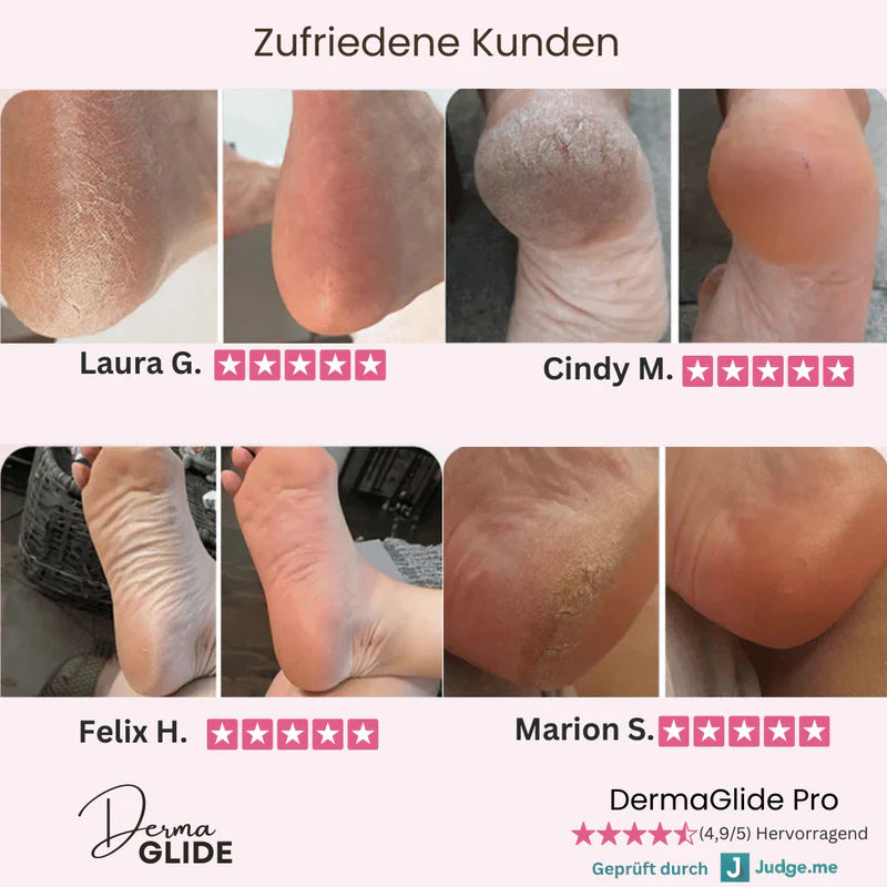 DermaGlide Pro - sofort geschmeidige Füße