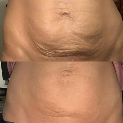 Vaultrys™ - Anti-Cellulite Elixir