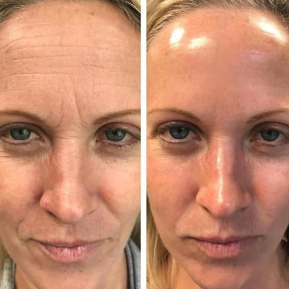 Botox Serum - sofortige Wirkung