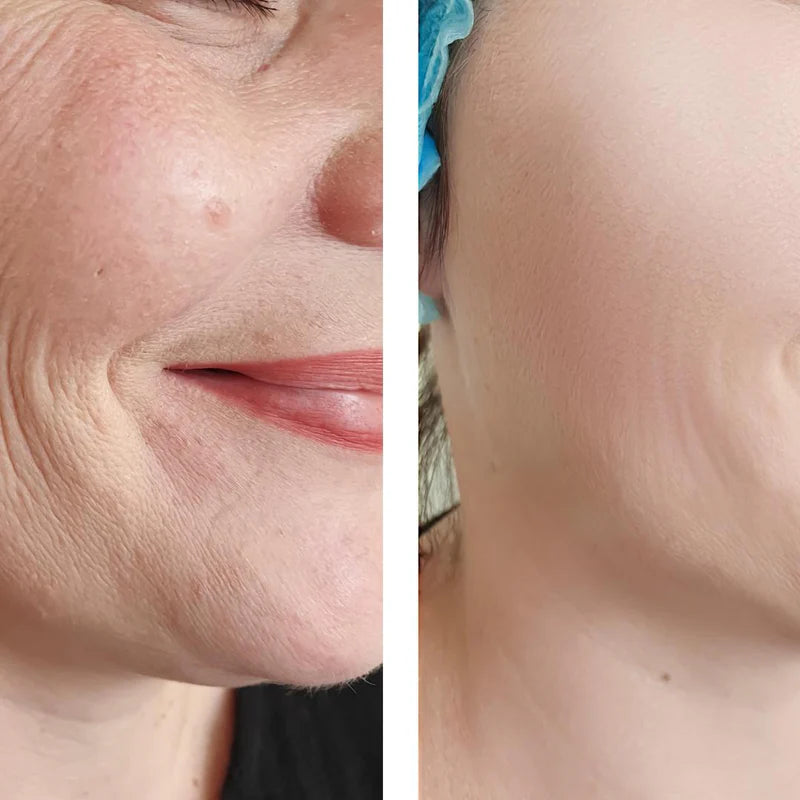Botox Serum - sofortige Wirkung