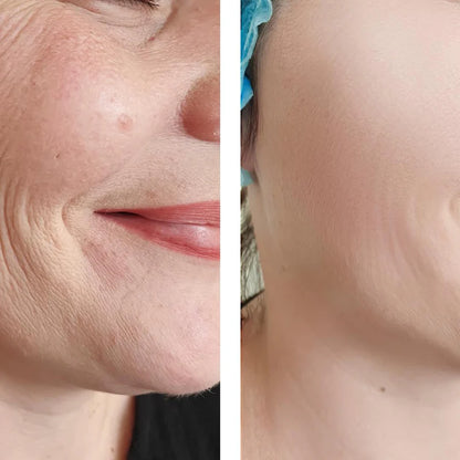 Botox Serum - sofortige Wirkung