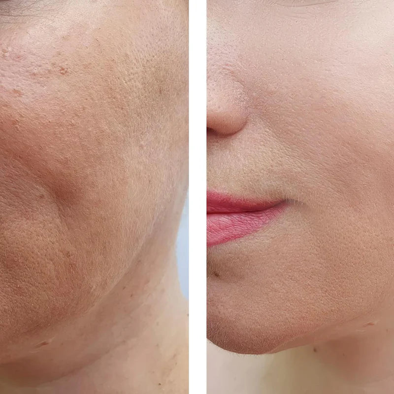 Botox Serum - sofortige Wirkung