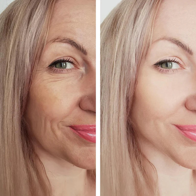 Botox Serum - sofortige Wirkung