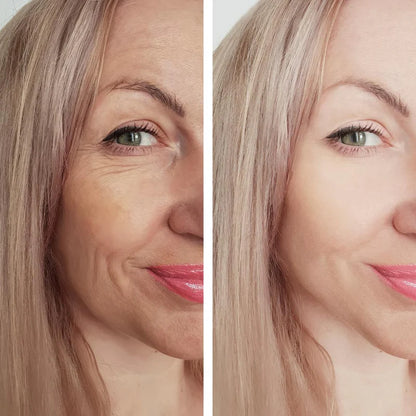Botox Serum - sofortige Wirkung